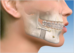 Jaw joint/facial pain care centre.