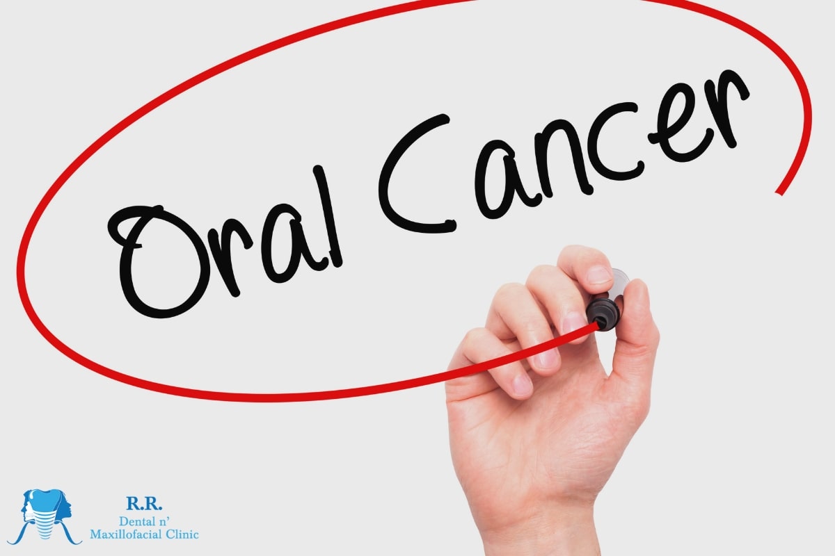 Symptoms Of Oral Cancer