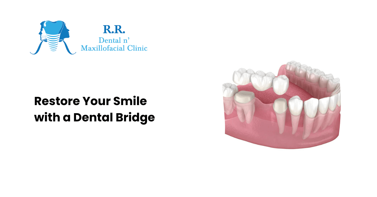 Restore Your Smile with a Dental Bridge