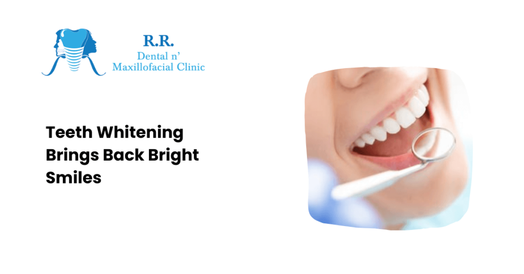 Teeth Whitening Brings Back Bright Smiles
